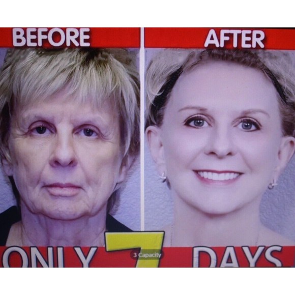 Retinol Serum for Skin Care Oil Drops Improve Elasticity .68 Fl.Oz. NIP - Picture 7 of 8